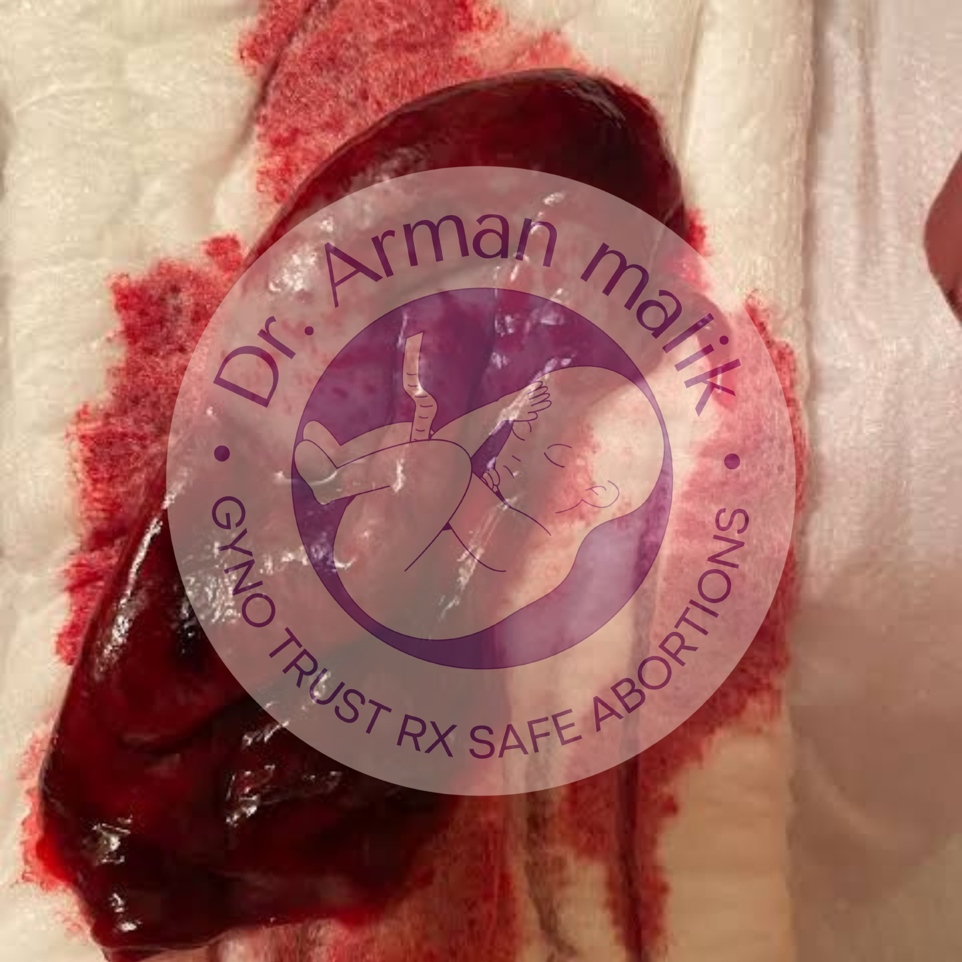 WhatsApp Image 2025-02-24 at 6.48.33 PM (2).jpeg